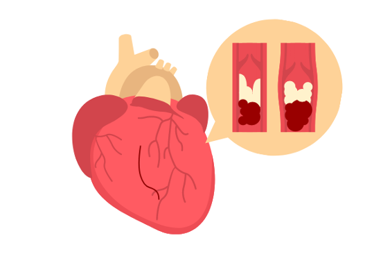 Heart Disease Project